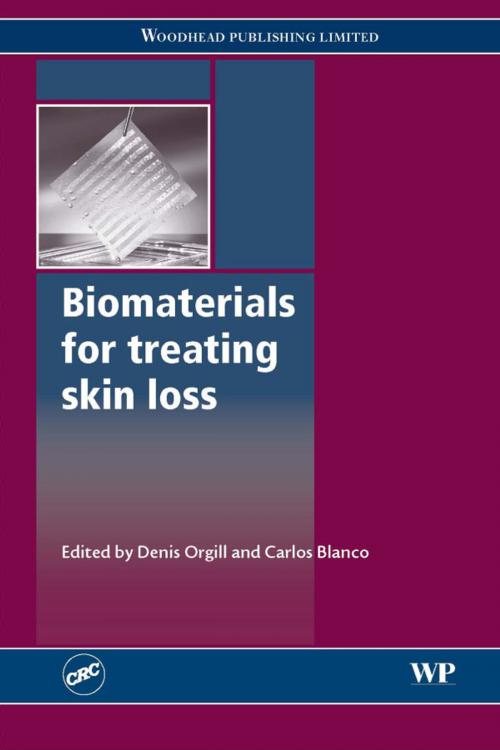 Cover of the book Biomaterials for Treating Skin Loss by , Elsevier Science