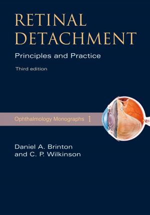 Cover of the book Retinal Detachment by Melissa Jonson-Reid, Brett Drake