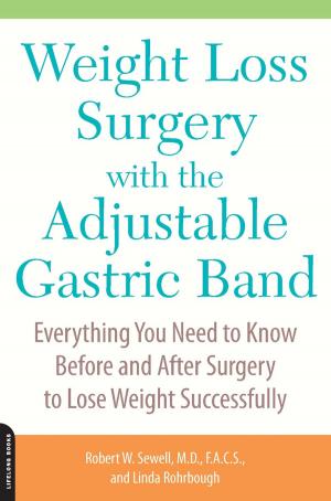 Cover of the book Weight Loss Surgery with the Adjustable Gastric Band by Holly Hughes