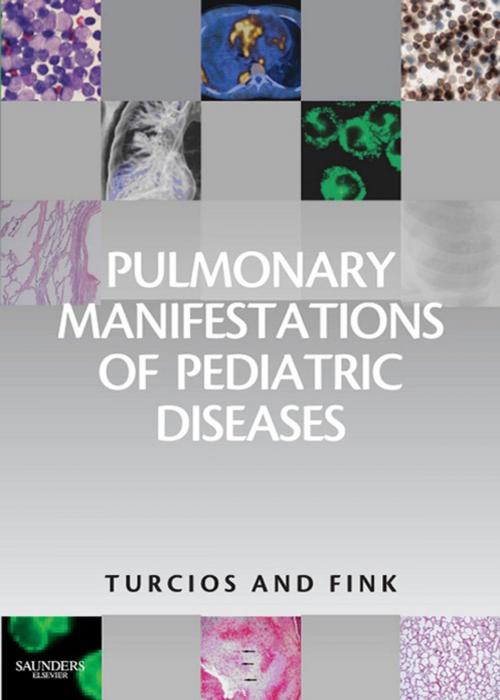 Cover of the book Pulmonary Manifestations of Pediatric Diseases E-Book by Nelson L. Turcios, MD, Robert J. Fink, MD, Elsevier Health Sciences