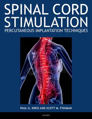 Cover of the book Spinal Cord Stimulation Implantation by James V. Wertsch
