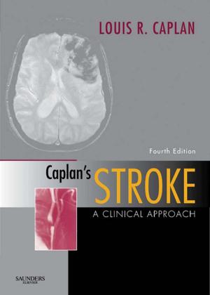Cover of the book Caplan's Stroke E-Book by Julia A. Drose, BA, RDMS, RDCS, RVT