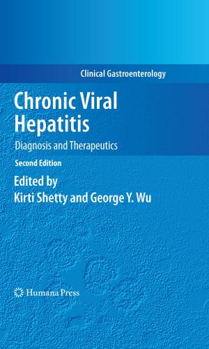 Cover of the book Chronic Viral Hepatitis by Albert A. Luderer, Howard H. Weetall