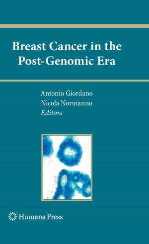 Cover of the book Breast Cancer in the Post-Genomic Era by Sitharama S. Iyengar, Kianoosh G. Boroojeni, N. Balakrishnan