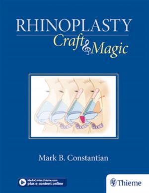 Cover of the book Rhinoplasty by Harold Koplewicz
