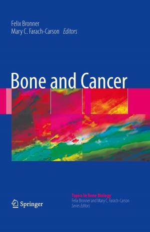 Cover of the book Bone and Cancer by Il-Chul Moon, Kathleen M. Carley, Tag Gon Kim