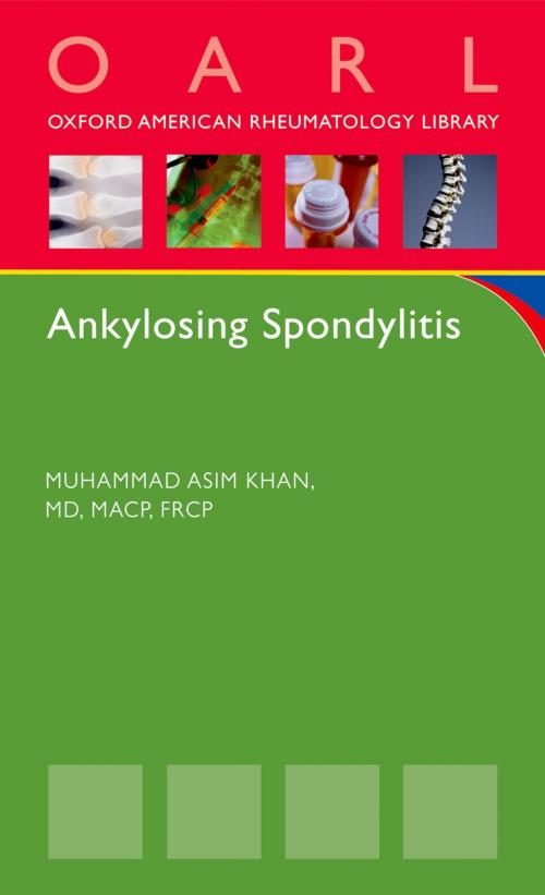 Cover of the book Ankylosing Spondylitis by Muhammad Asim Khan, Oxford University Press