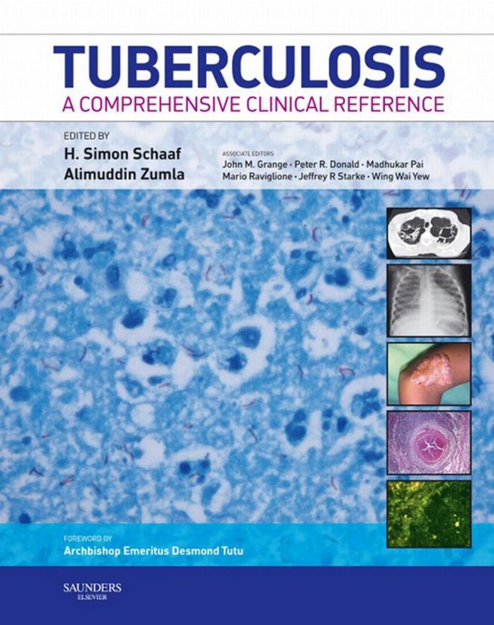 Big bigCover of Tuberculosis E-Book