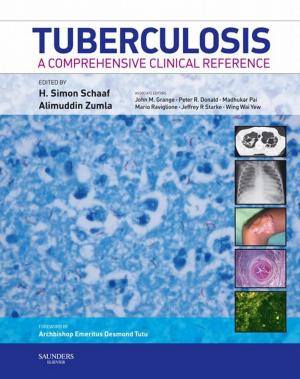 Cover of the book Tuberculosis E-Book by Thomas J Sitzman, MD