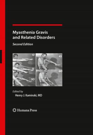 Cover of the book Myasthenia Gravis and Related Disorders by Shuko Suzuki, Yoshito Ikada