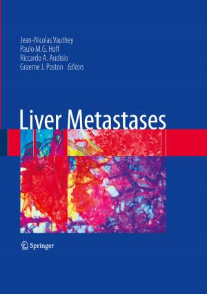 Cover of the book Liver Metastases by Torben Ægidius Mogensen