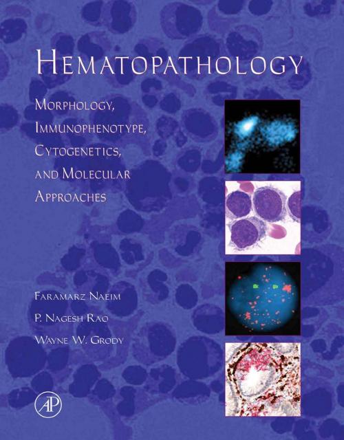 Cover of the book Hematopathology by P. Nagesh Rao, Wayne W. Grody, Faramarz Naeim, MD, Elsevier Science