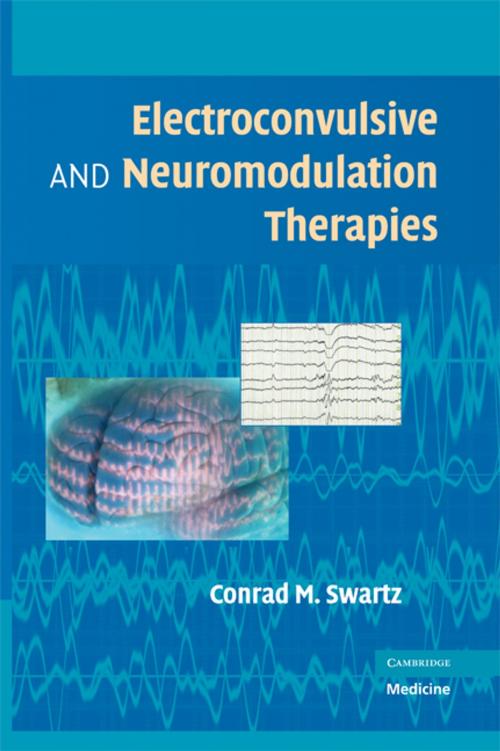 Cover of the book Electroconvulsive and Neuromodulation Therapies by , Cambridge University Press