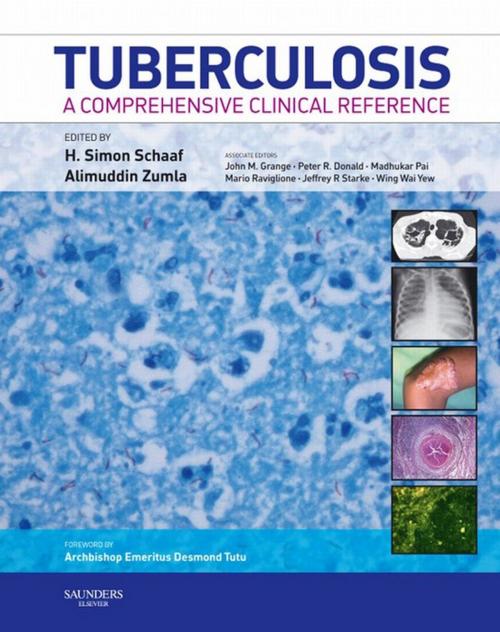 Cover of the book Tuberculosis E-Book by H. Simon Schaaf, MBChB(Stellenbosch), MMed Paed(Stellenbosch), DCM(Stellenbosch), MD Paed(Stellenbosch), Alimuddin Zumla, BSc.MBChB.MSc.PhD.FRCP(Lond).FRCP(Edin).FRCPath(UK), Elsevier Health Sciences