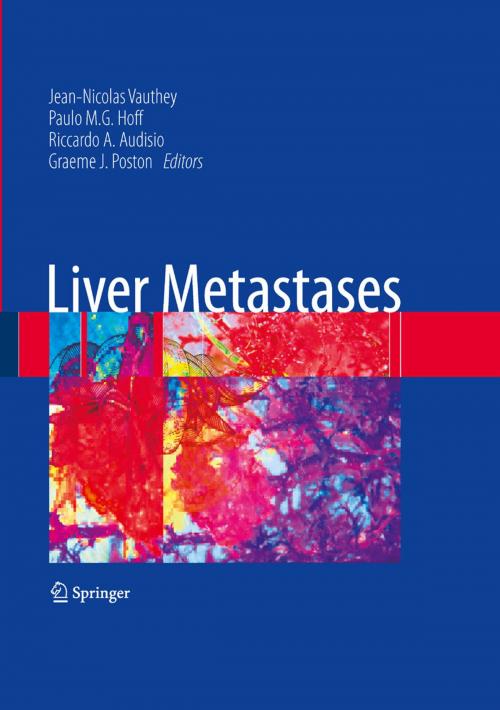 Cover of the book Liver Metastases by , Springer London