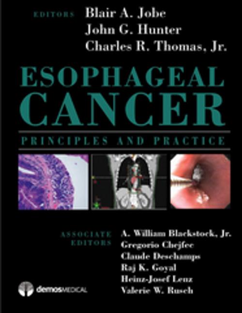 Cover of the book Esophageal Cancer by Thomas R. Charles, MD, Dr. John G. Hunter, MD, Blair A. Jobe, MD, Springer Publishing Company