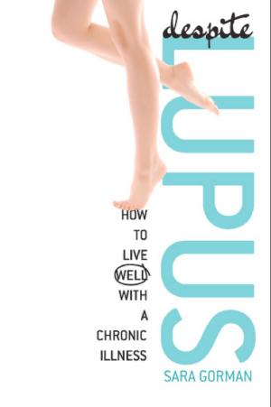 Cover of the book Despite Lupus by Sally Lloyd