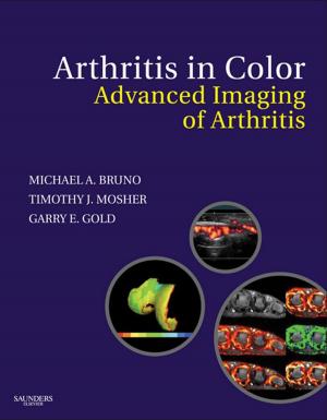 Cover of the book Arthritis in Color E-Book by Nitin Puri, MD, Michael Baram, MD, Nicholas Cavarocchi, MD, FACS, FCCP