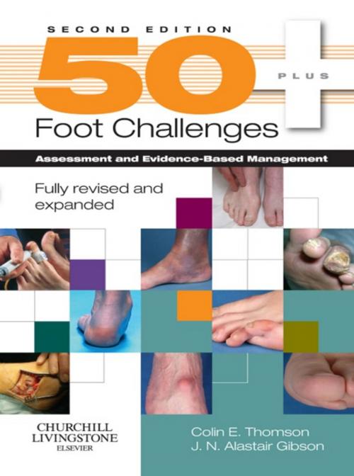 Cover of the book 50+ Foot Challenges by Colin Thomson, J. N. Alastair Gibson, Elsevier Health Sciences UK
