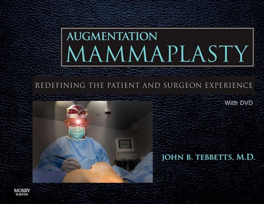 Big bigCover of Augmentation Mammaplasty E-Book