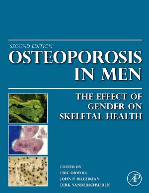 Cover of the book Osteoporosis in Men by Donald L. Sparks