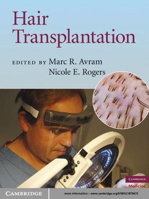 Cover of the book Hair Transplantation by Professor Audie Klotz