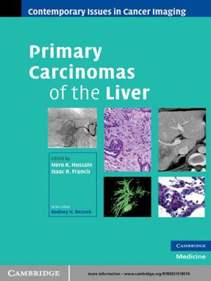 Cover of the book Primary Carcinomas of the Liver by Immanuel Kant