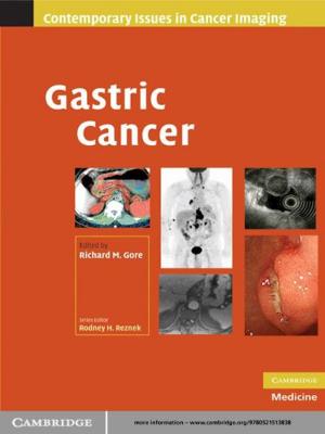Cover of the book Gastric Cancer by Mark Dincecco, Massimiliano Gaetano Onorato
