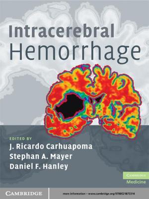 Cover of the book Intracerebral Hemorrhage by Joel F. Handler