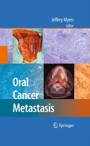 Cover of the book Oral Cancer Metastasis by C. Alexander Valencia, M. Ali Pervaiz, Ammar Husami, Yaping Qian, Kejian Zhang