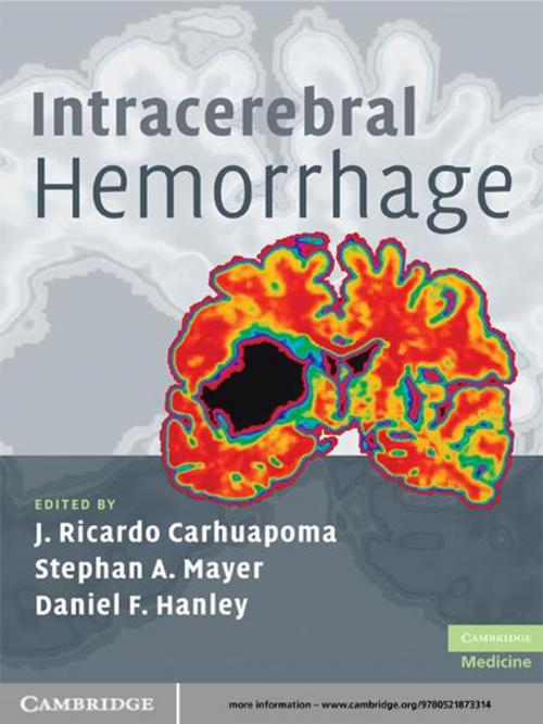 Cover of the book Intracerebral Hemorrhage by , Cambridge University Press