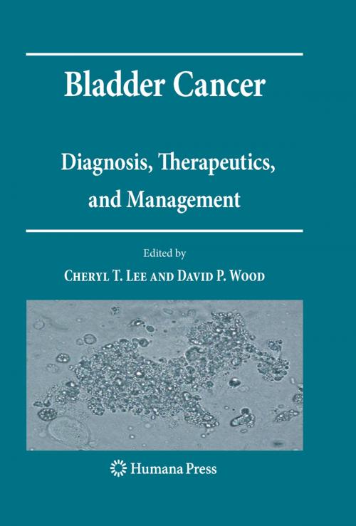 Cover of the book Bladder Cancer by , Humana Press