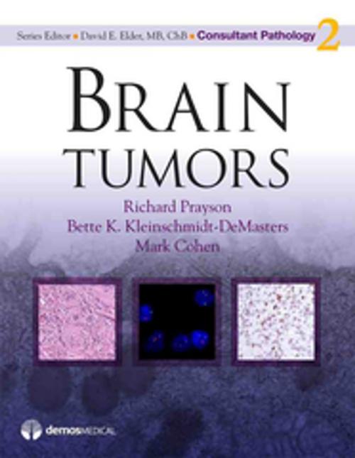 Cover of the book Brain Tumors by Mark Cohen, MD, David Elder, MB, ChB, Bette K. Kleinschmidt-DeMasters, MD, Richard Prayson, MD, Springer Publishing Company