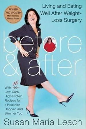 Cover of the book Before & After, Revised Edition by Lisa White, Glenys Falloon, Hayley Richards, Anne Clark, Karina Pike