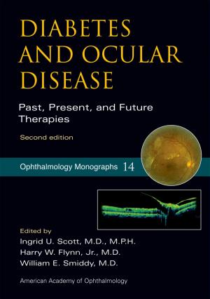 Cover of the book Diabetes and Ocular Disease by Simon Blackburn
