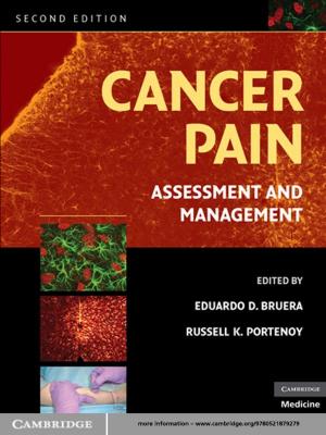 Cover of the book Cancer Pain by Adriana Craciun