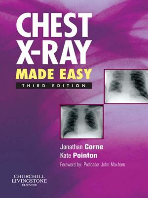 Book cover of Chest X-Ray Made Easy E-Book