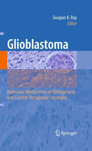 Cover of the book Glioblastoma: by Carol Yeh-Yun Lin, Leif Edvinsson, Jeffrey Chen, Tord Beding