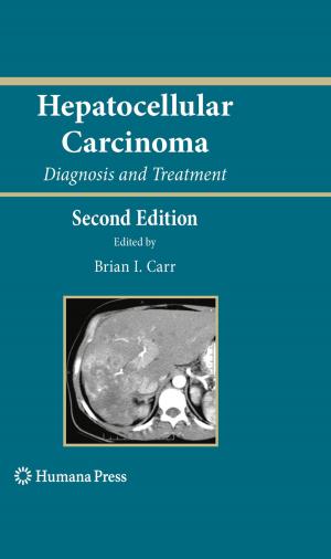 Cover of the book Hepatocellular Carcinoma by Kewal K. Jain