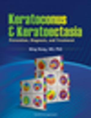 Cover of the book Keratoconus and Keratoectasia by 