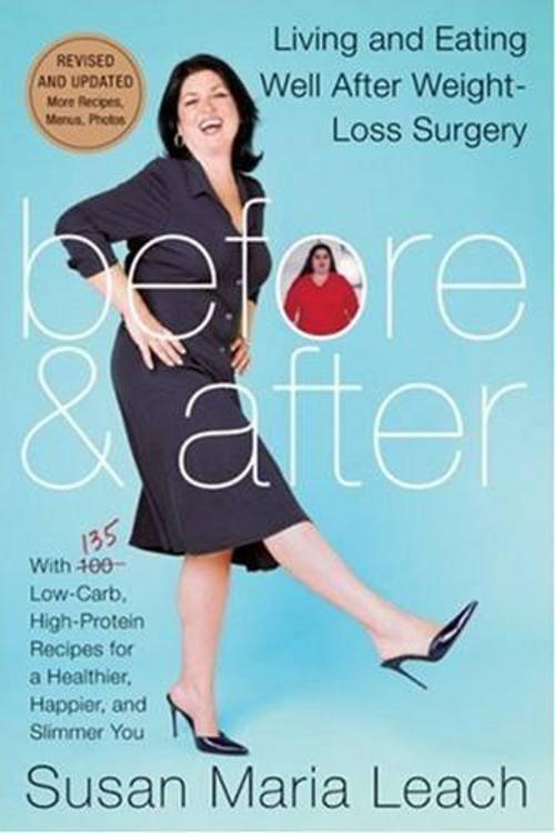 Cover of the book Before & After, Revised Edition by Susan Maria Leach, HarperCollins e-books