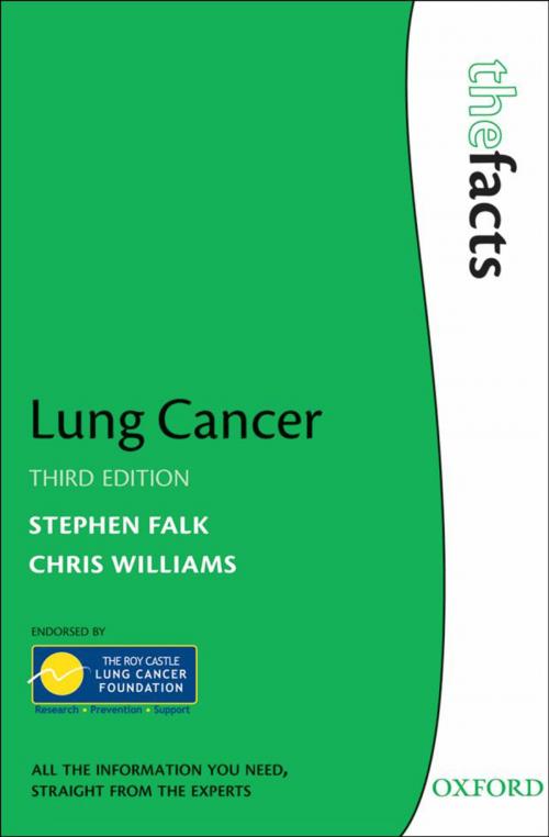 Cover of the book Lung Cancer by Stephen Falk, Chris Williams, OUP Oxford