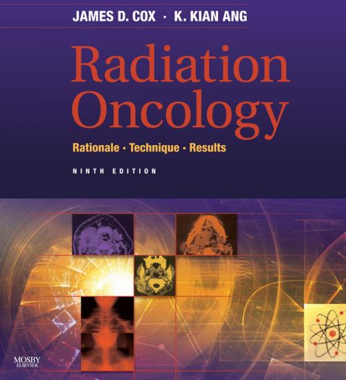 Cover of the book Radiation Oncology E-Book by James D. Cox, MD, FACR, Kie Kian Ang, MD, PhD, Elsevier Health Sciences