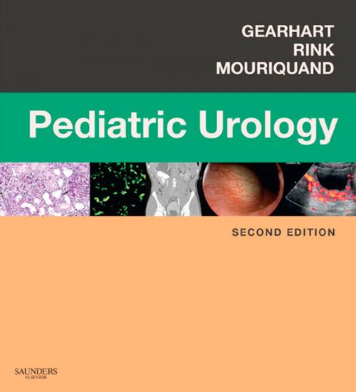 Cover of the book Pediatric Urology E-Book by John G. Gearhart, MD, FACS, Richard C. Rink, MD, Pierre D. E. Mouriquand, MD, FRCS(Eng), Elsevier Health Sciences