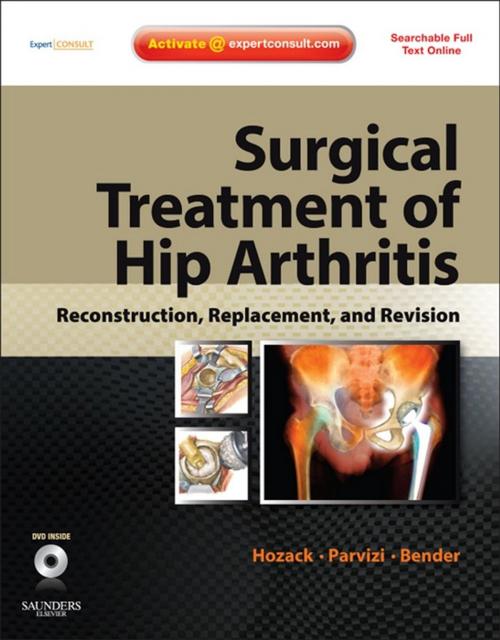 Cover of the book Surgical Treatment of Hip Arthritis: Reconstruction, Replacement, and Revision E-Book by William Hozack, MD, Javad Parvizi, MD, Benjamin Bender, Elsevier Health Sciences