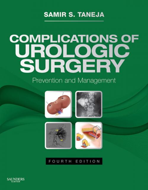Cover of the book Complications of Urologic Surgery E-Book by Samir S. Taneja, MD, Elsevier Health Sciences