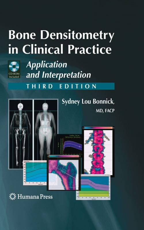 Cover of the book Bone Densitometry in Clinical Practice by Sydney Lou Bonnick, Humana Press