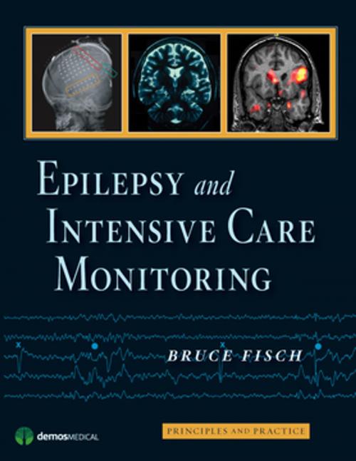 Cover of the book Epilepsy and Intensive Care Monitoring by Bruce Fisch, MD, Springer Publishing Company