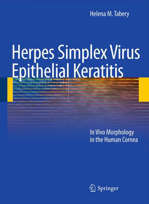 Cover of the book Herpes Simplex Virus Epithelial Keratitis by Helena M. Tabery, Springer Berlin Heidelberg