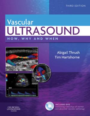 Cover of Vascular Ultrasound E-Book
